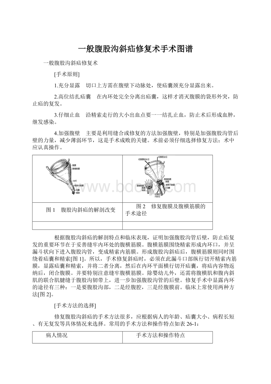 一般腹股沟斜疝修复术手术图谱.docx_第1页