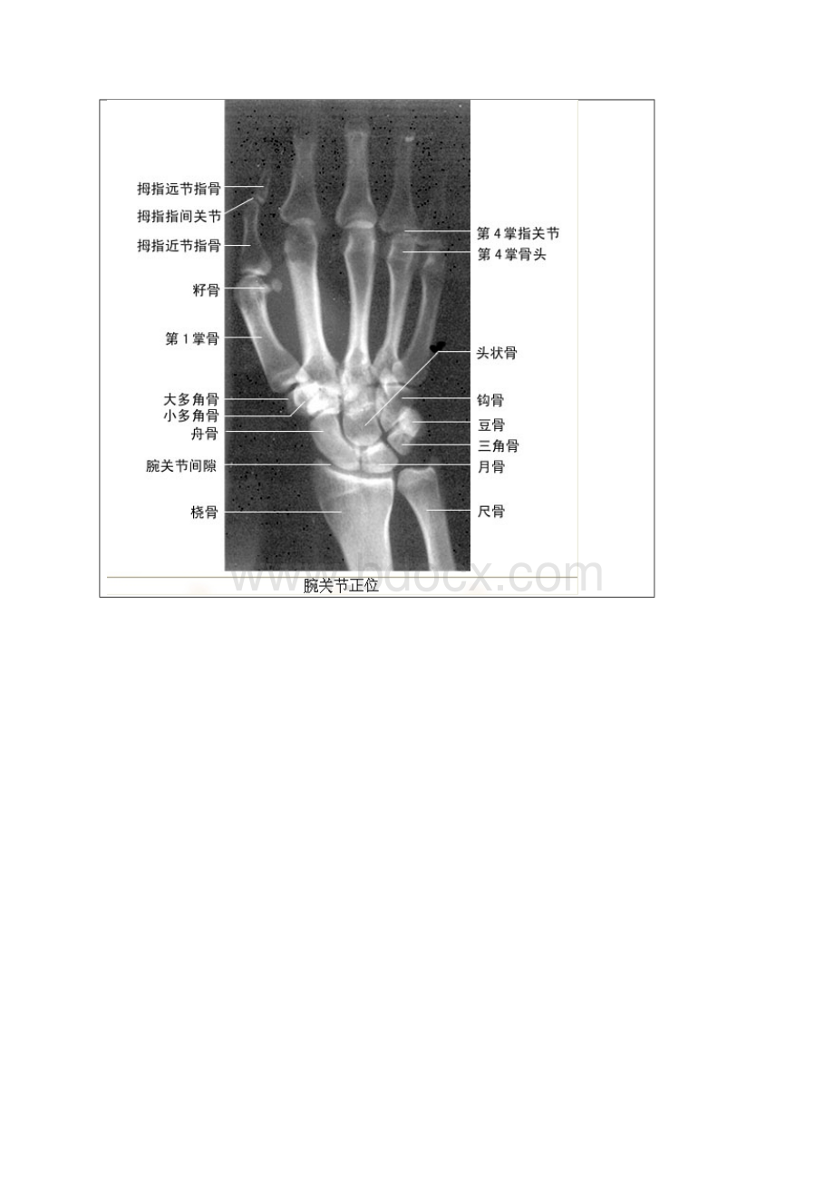 x光解剖.docx_第2页