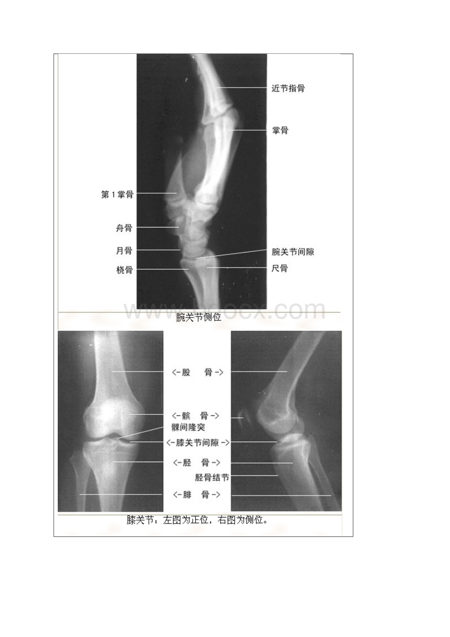 x光解剖.docx_第3页