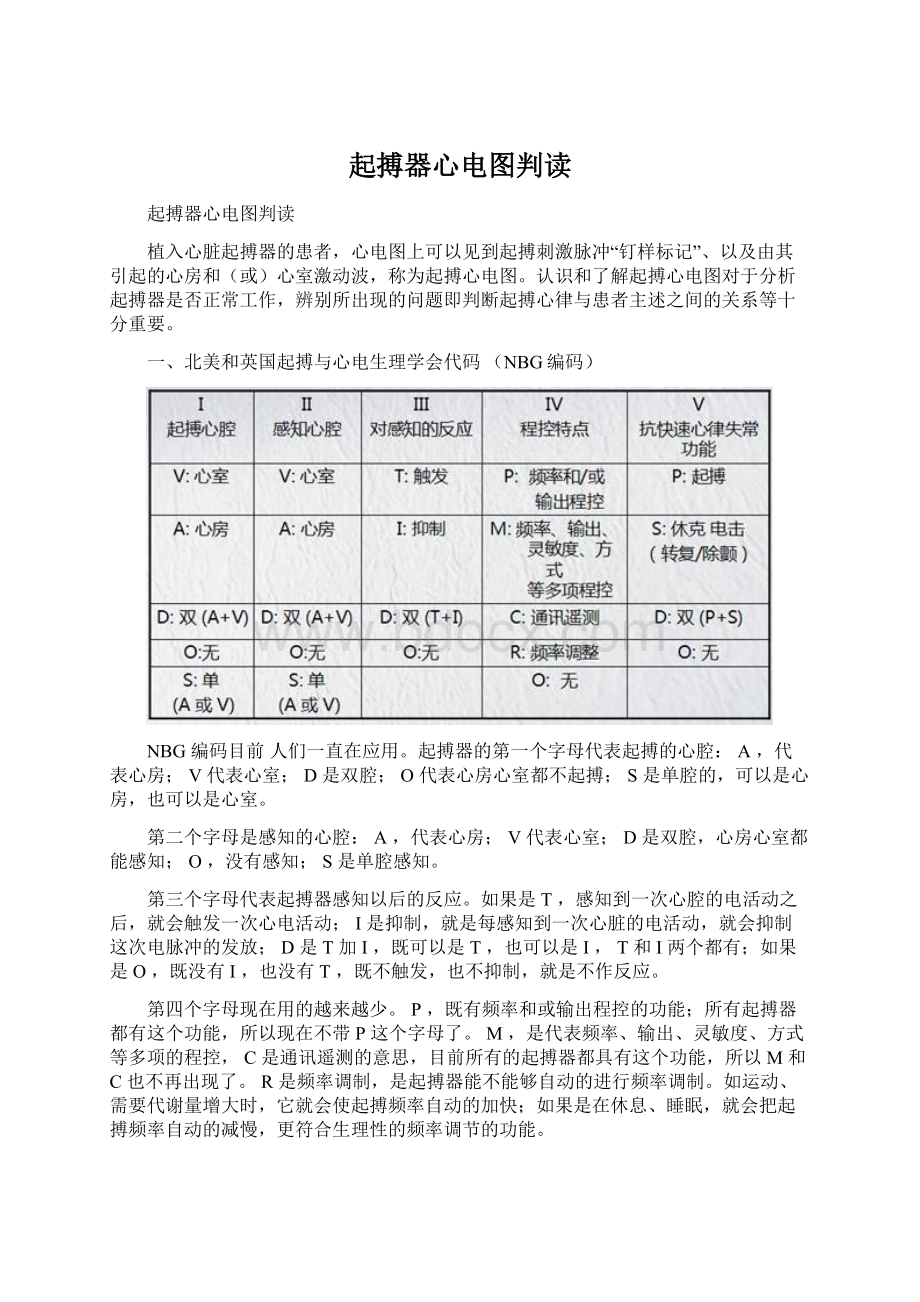 起搏器心电图判读.docx