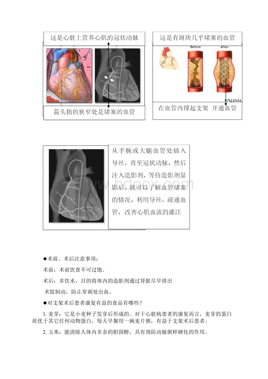 内科健康宣教文档格式.docx_第3页