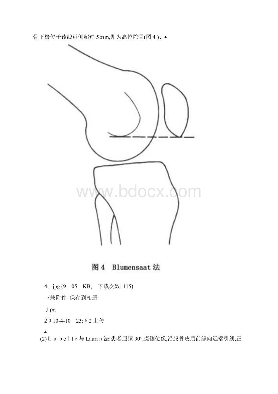 髌骨不稳的判断.docx_第2页