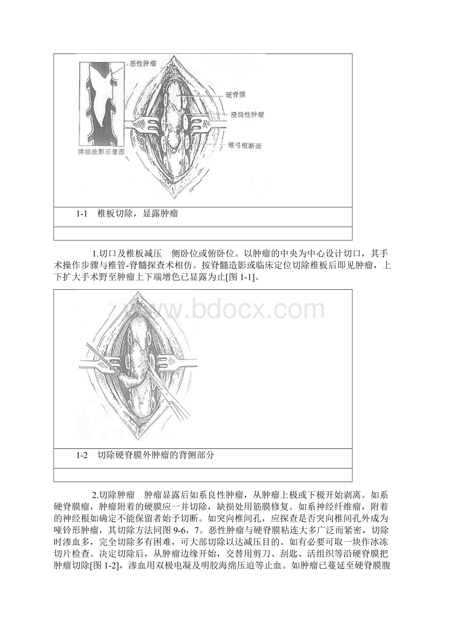 神外手术.docx_第2页