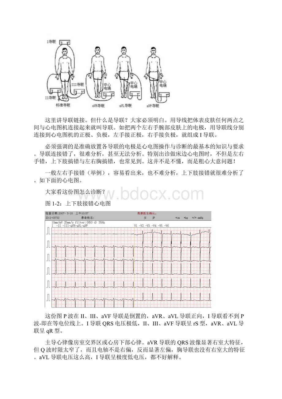 另类心电图学讲义1电极安装QRS命名与测量Word文件下载.docx_第3页