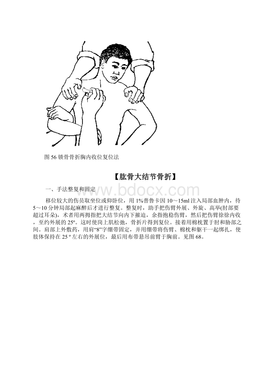 骨折手法整复方法Word下载.docx_第2页