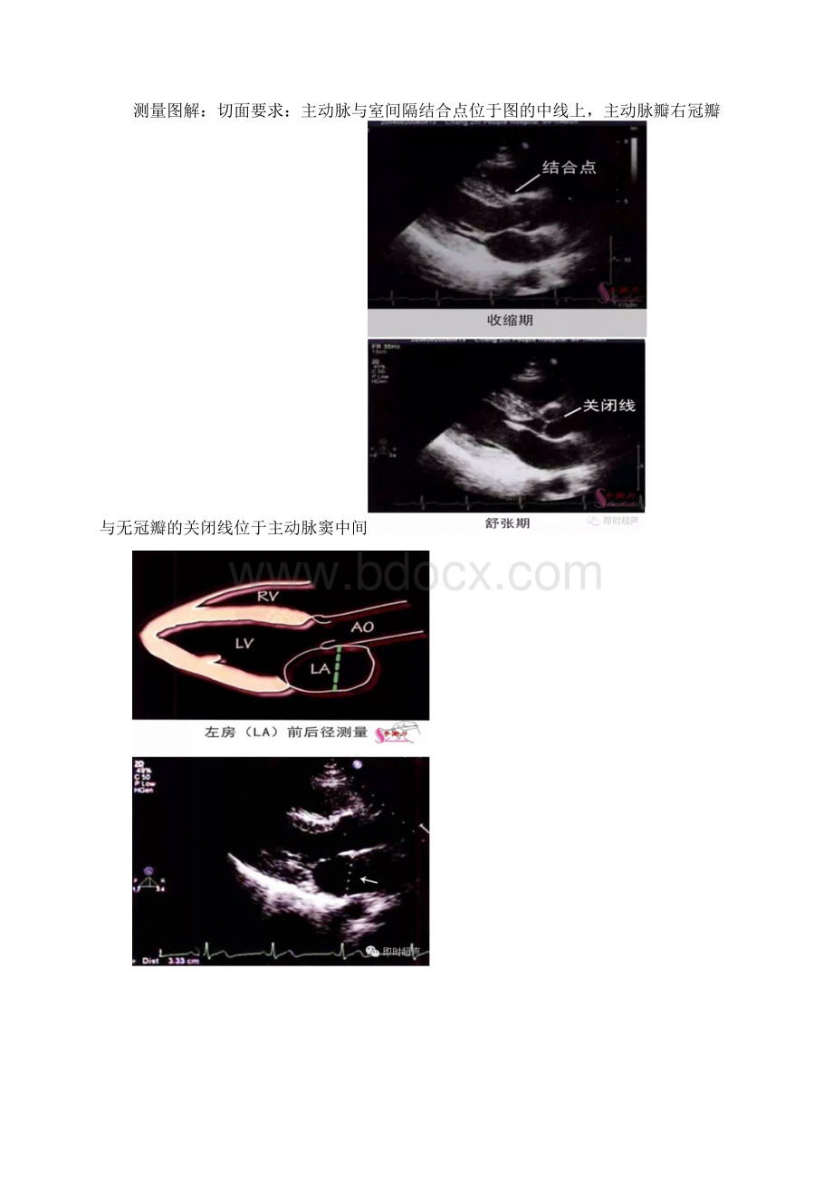 超声心动图测量技巧及现用图解.docx_第2页