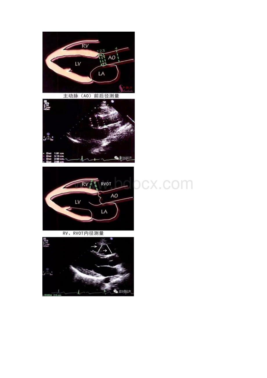 超声心动图测量技巧及现用图解Word格式文档下载.docx_第3页