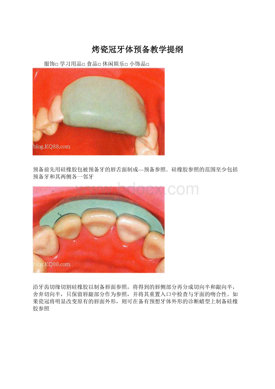 烤瓷冠牙体预备教学提纲.docx_第1页