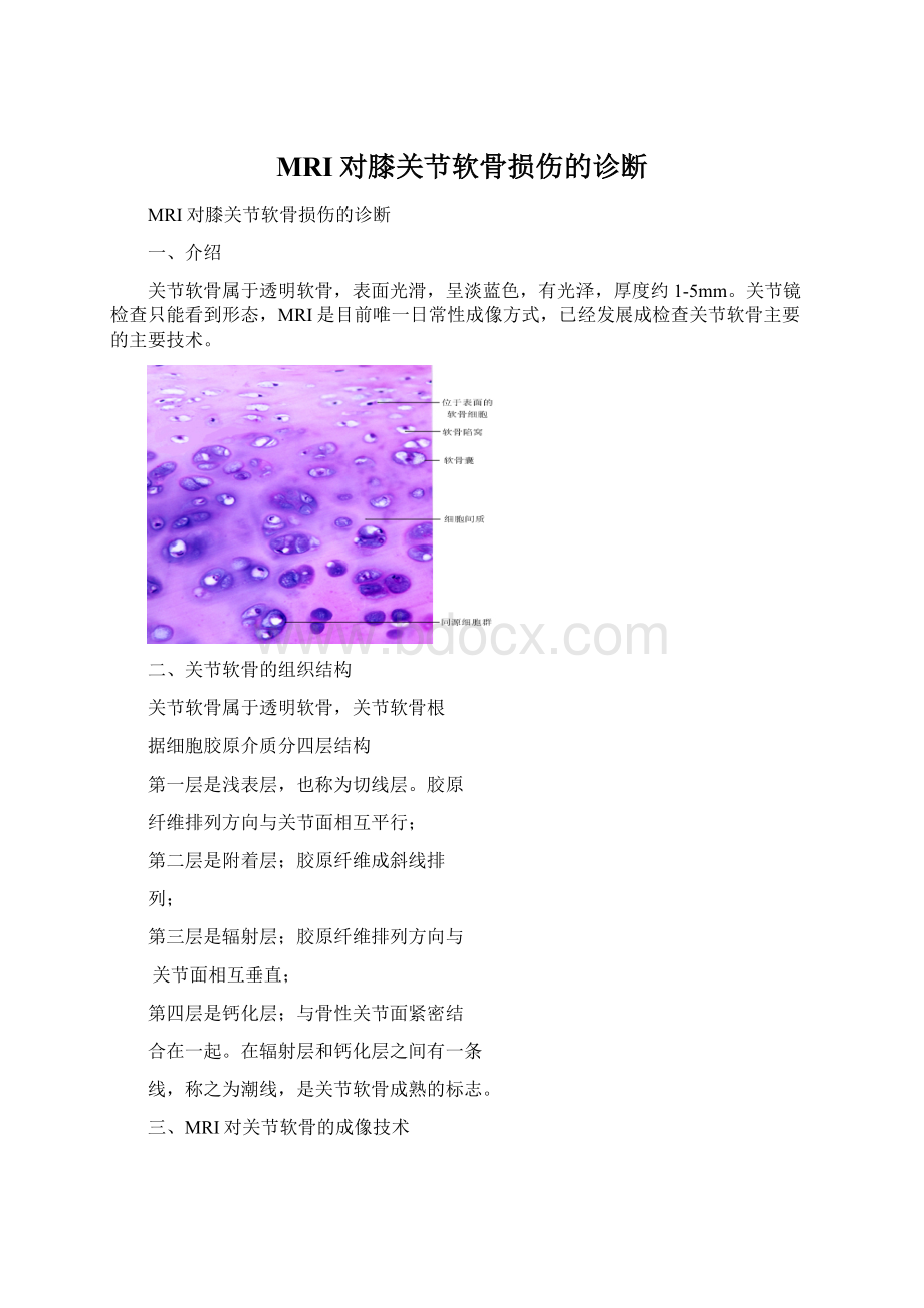 MRI对膝关节软骨损伤的诊断.docx_第1页