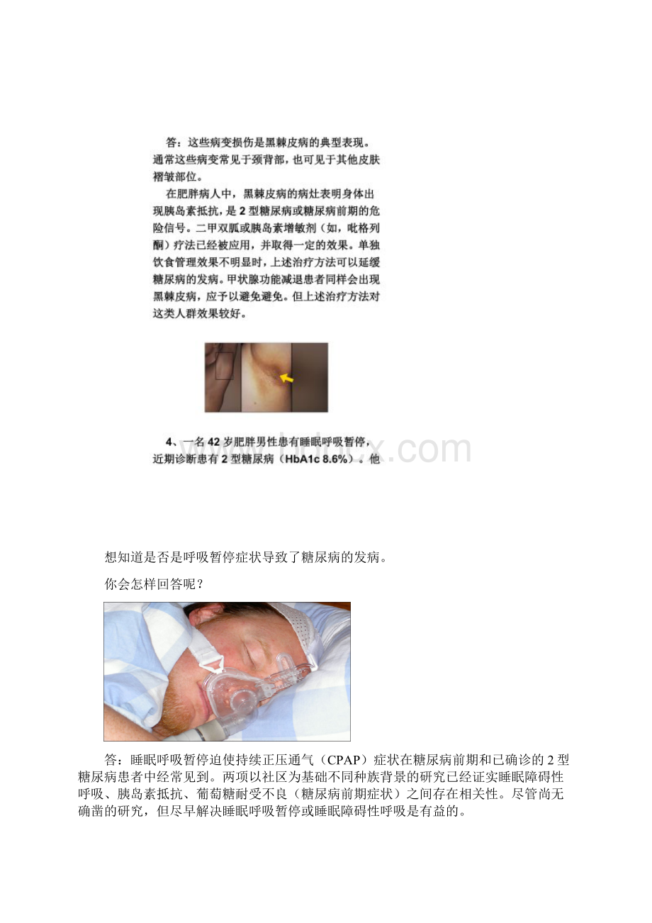 图解糖尿病临床表现.docx_第3页