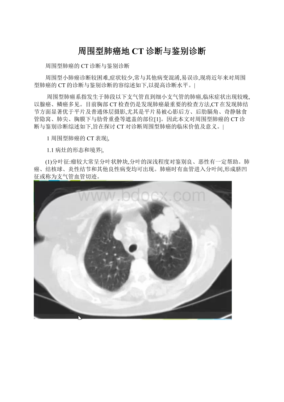 周围型肺癌地CT诊断与鉴别诊断Word格式文档下载.docx