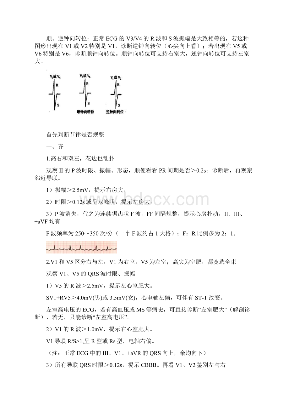 郭雅卿老师心电图口诀.docx_第2页