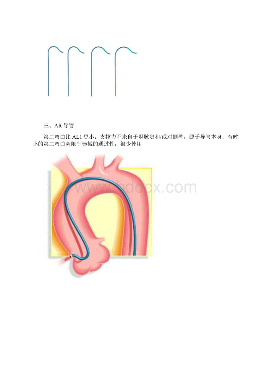 右冠状动脉指引导管的选择Word格式.docx_第3页