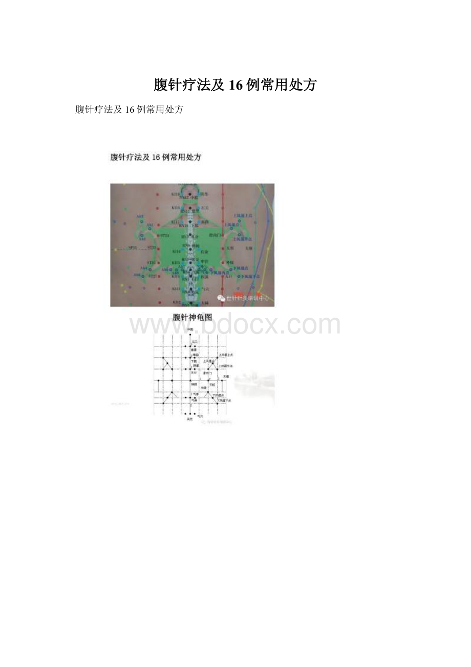 腹针疗法及16例常用处方.docx_第1页