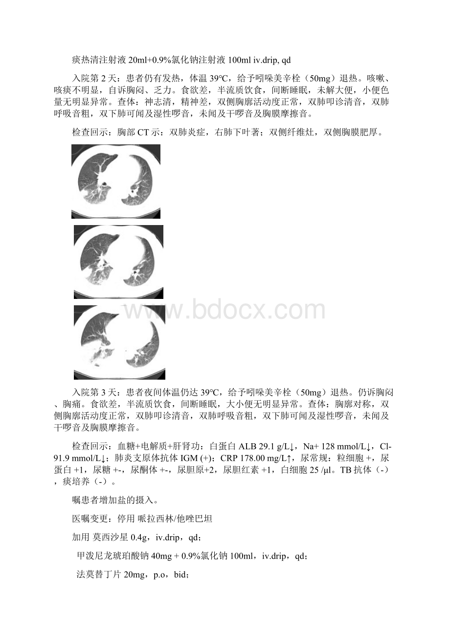 肺炎案例分析.docx_第2页