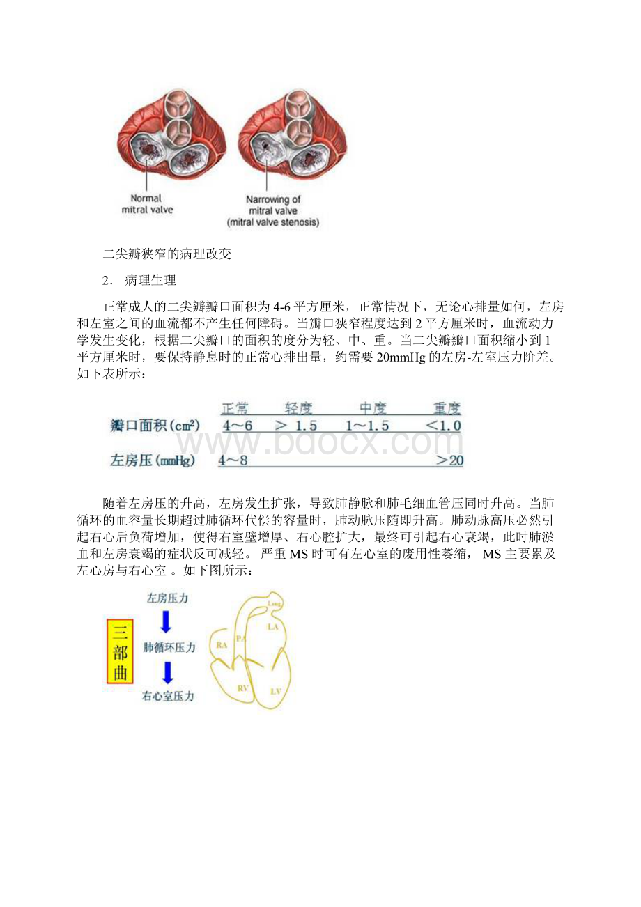 2心脏瓣膜病的病理生理和诊断.docx_第2页