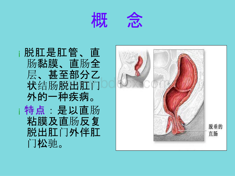 脱肛教学课件精选ppt文档优质PPT.pptx_第3页