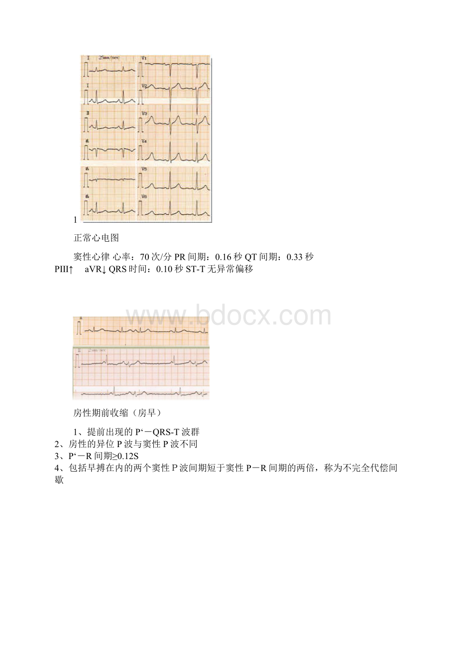 执业医师问答题.docx_第2页