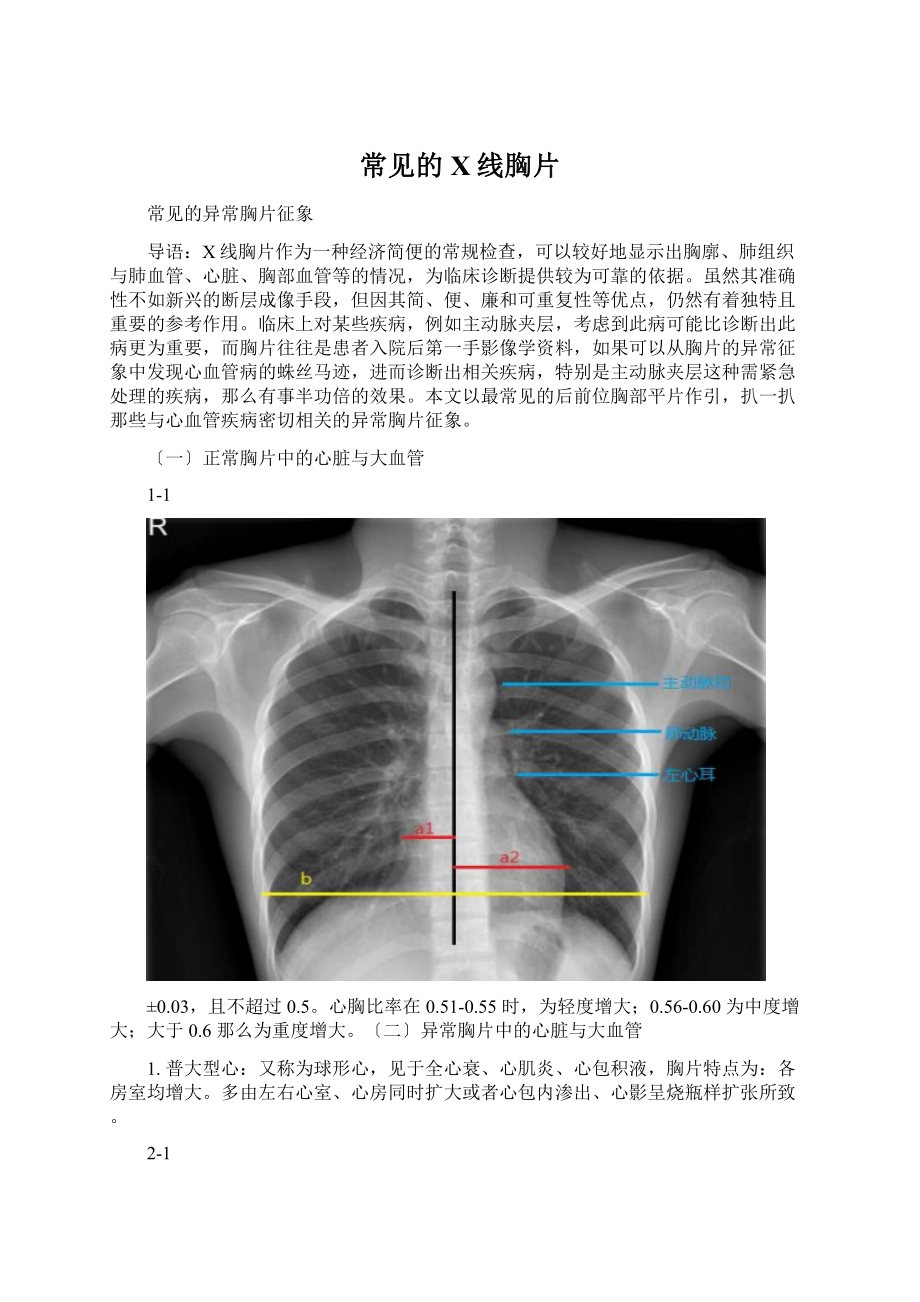 常见的X线胸片Word下载.docx_第1页