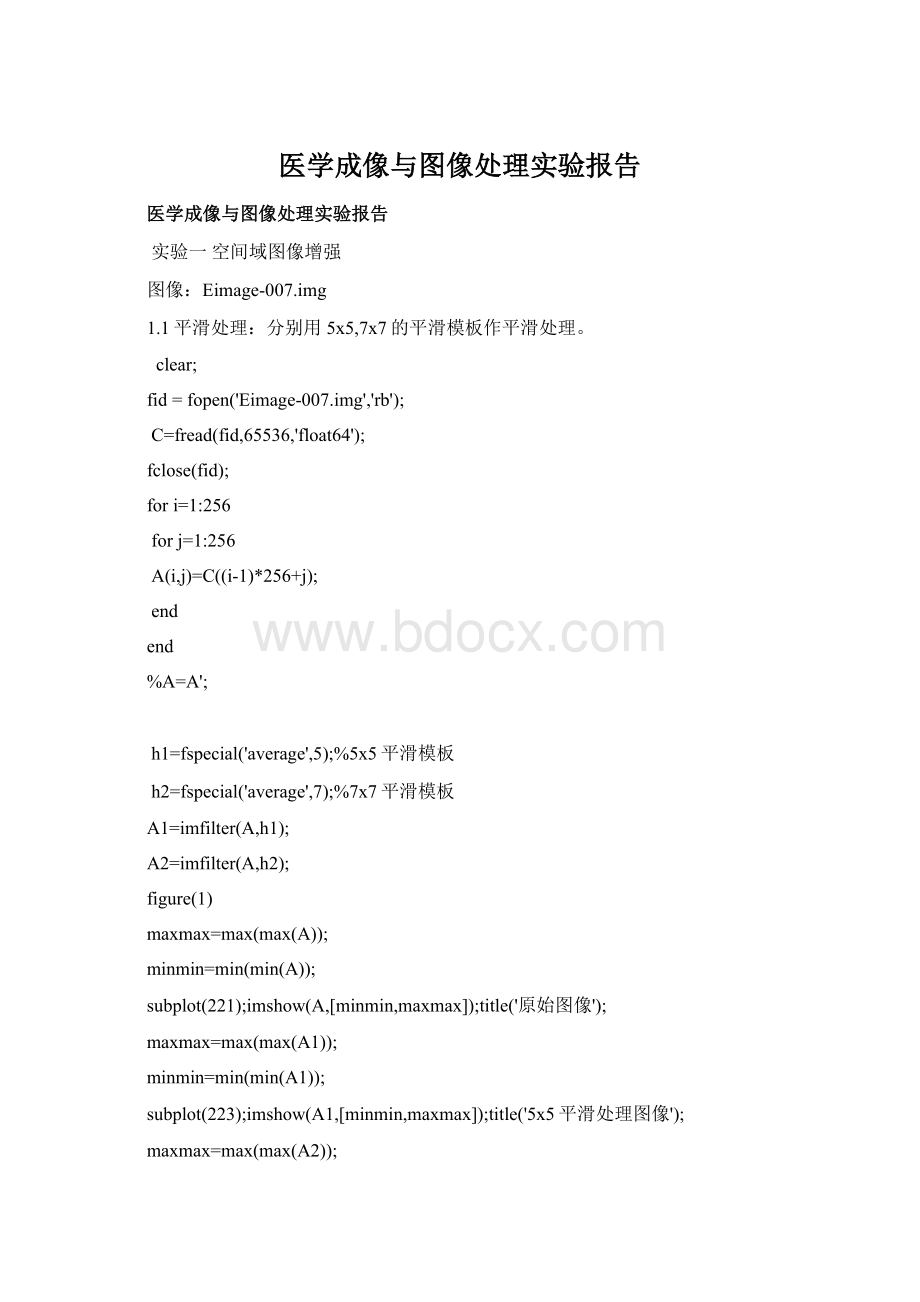 医学成像与图像处理实验报告Word文档下载推荐.docx