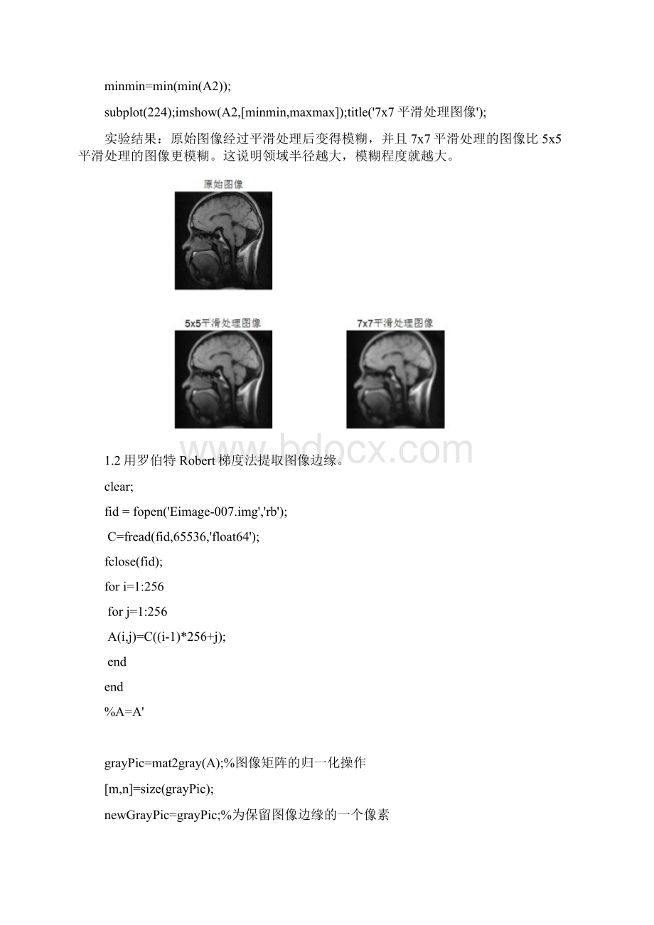 医学成像与图像处理实验报告.docx_第2页