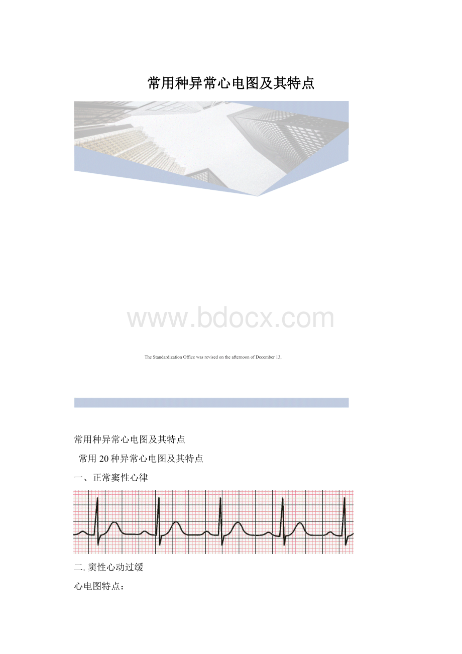 常用种异常心电图及其特点.docx