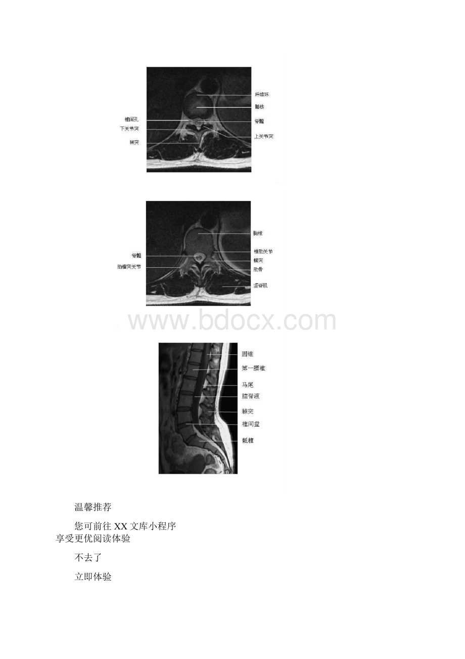 全身骨关节MRI断层解剖大全珍藏版超实用Word下载.docx_第3页