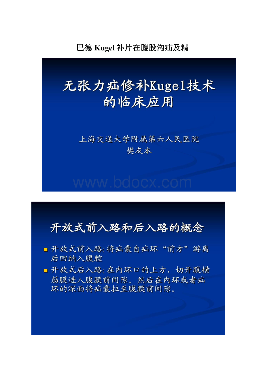 巴德Kugel补片在腹股沟疝及精.docx