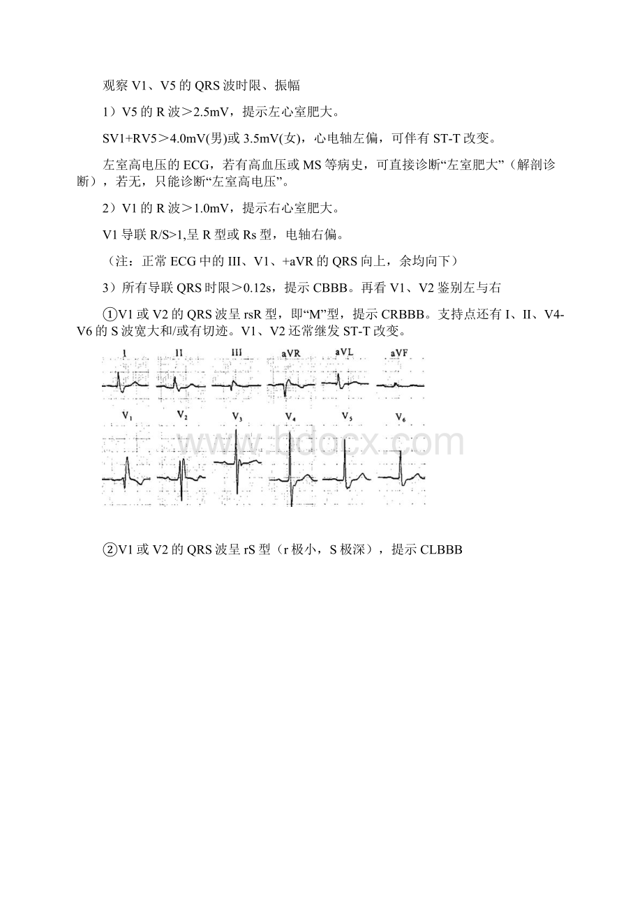 郭雅卿老师心电图口诀Word下载.docx_第2页