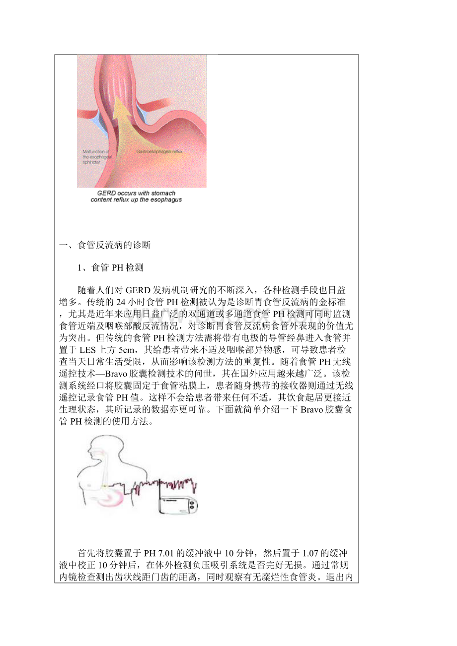 胃食管反流病诊治新进展Word格式文档下载.docx_第2页