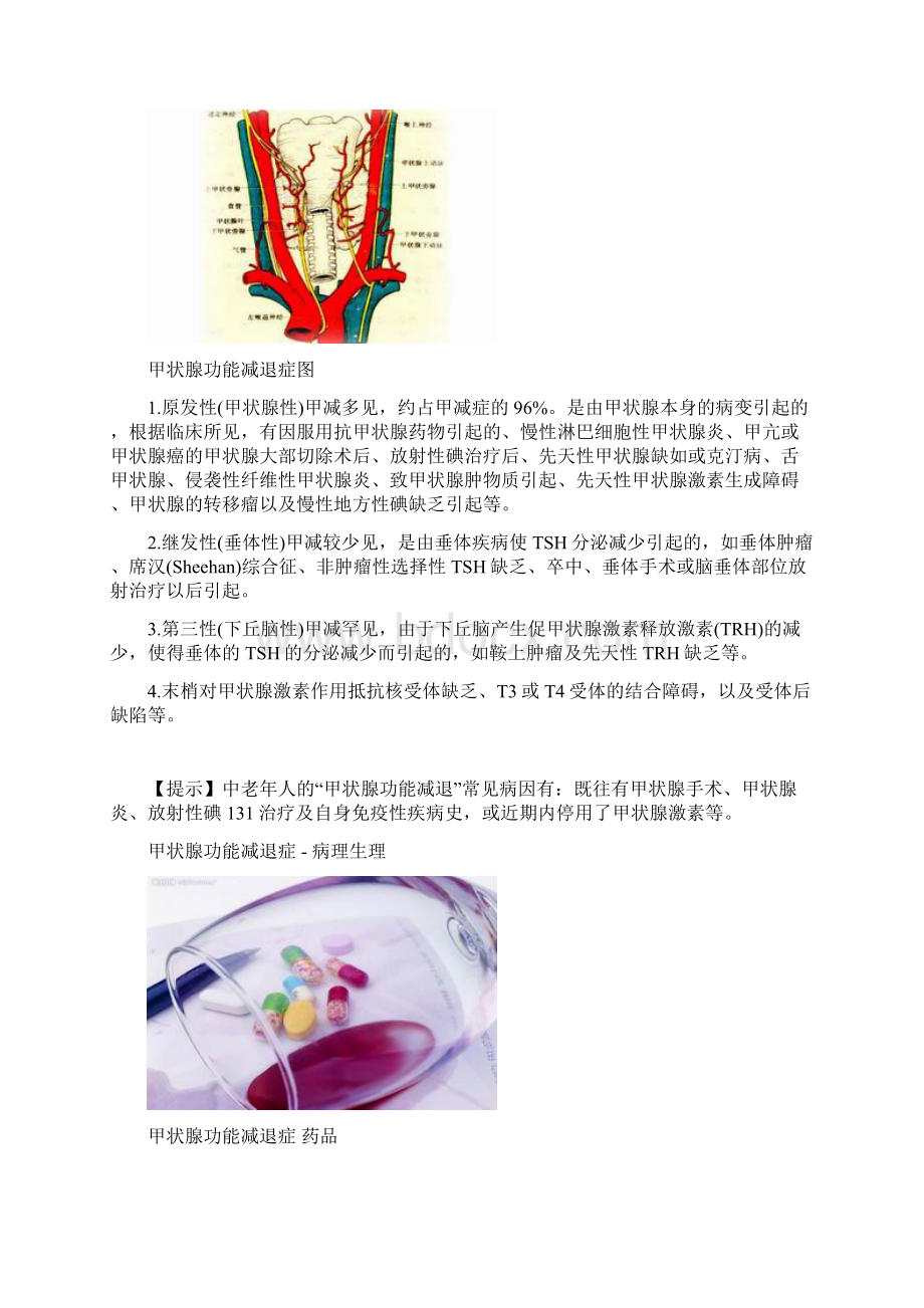 甲状腺功能减退症概述知识.docx_第3页