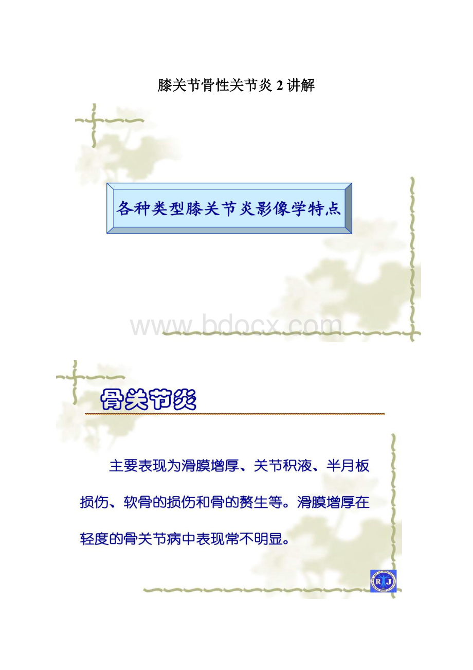 膝关节骨性关节炎2讲解.docx_第1页