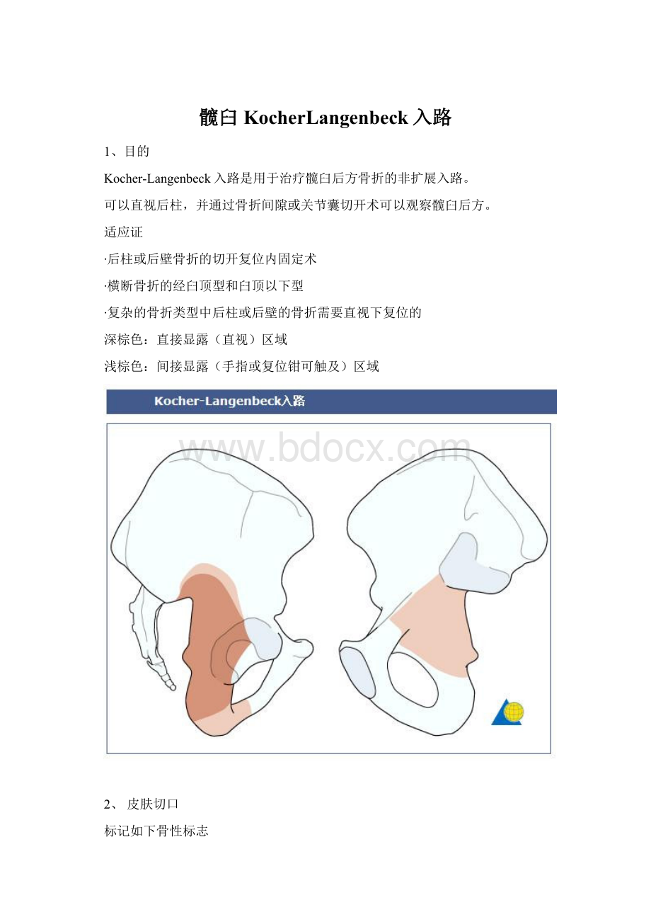 髋臼KocherLangenbeck入路.docx