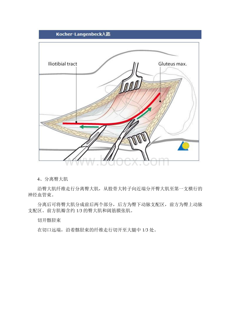 髋臼KocherLangenbeck入路Word文档格式.docx_第3页