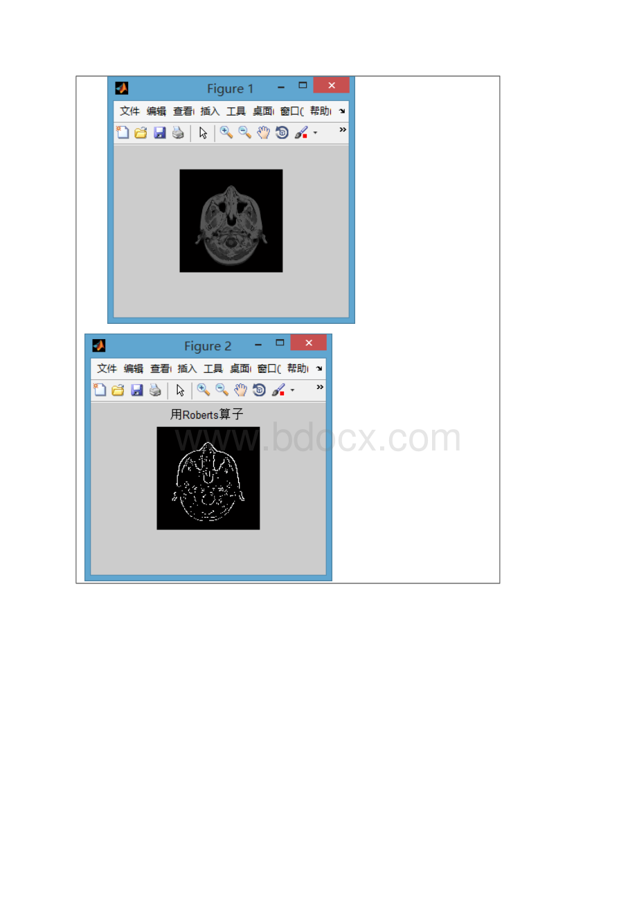 数字图像处理实验报告图像分割实验.docx_第3页