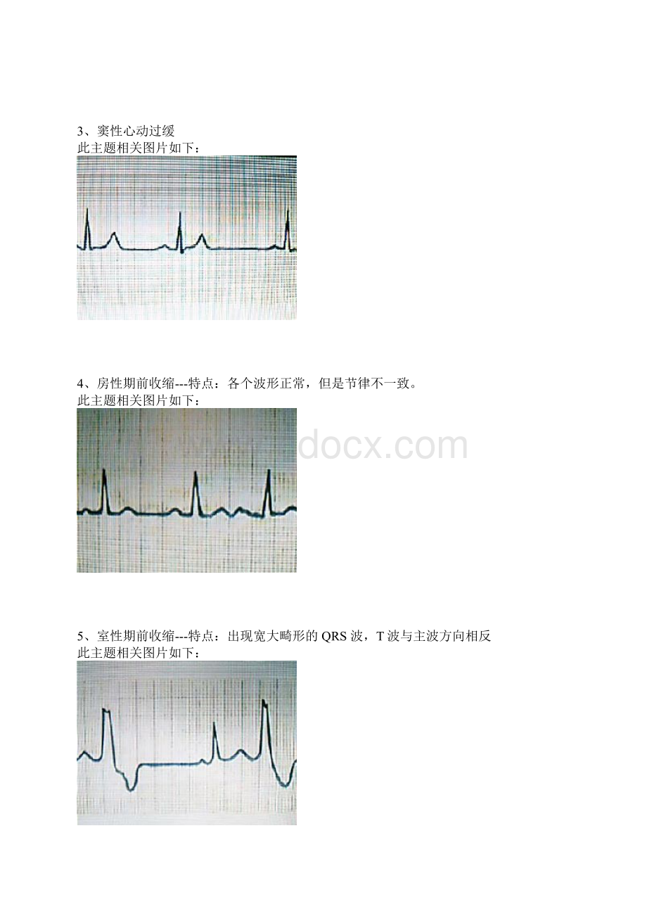 巧记心电图.docx_第3页