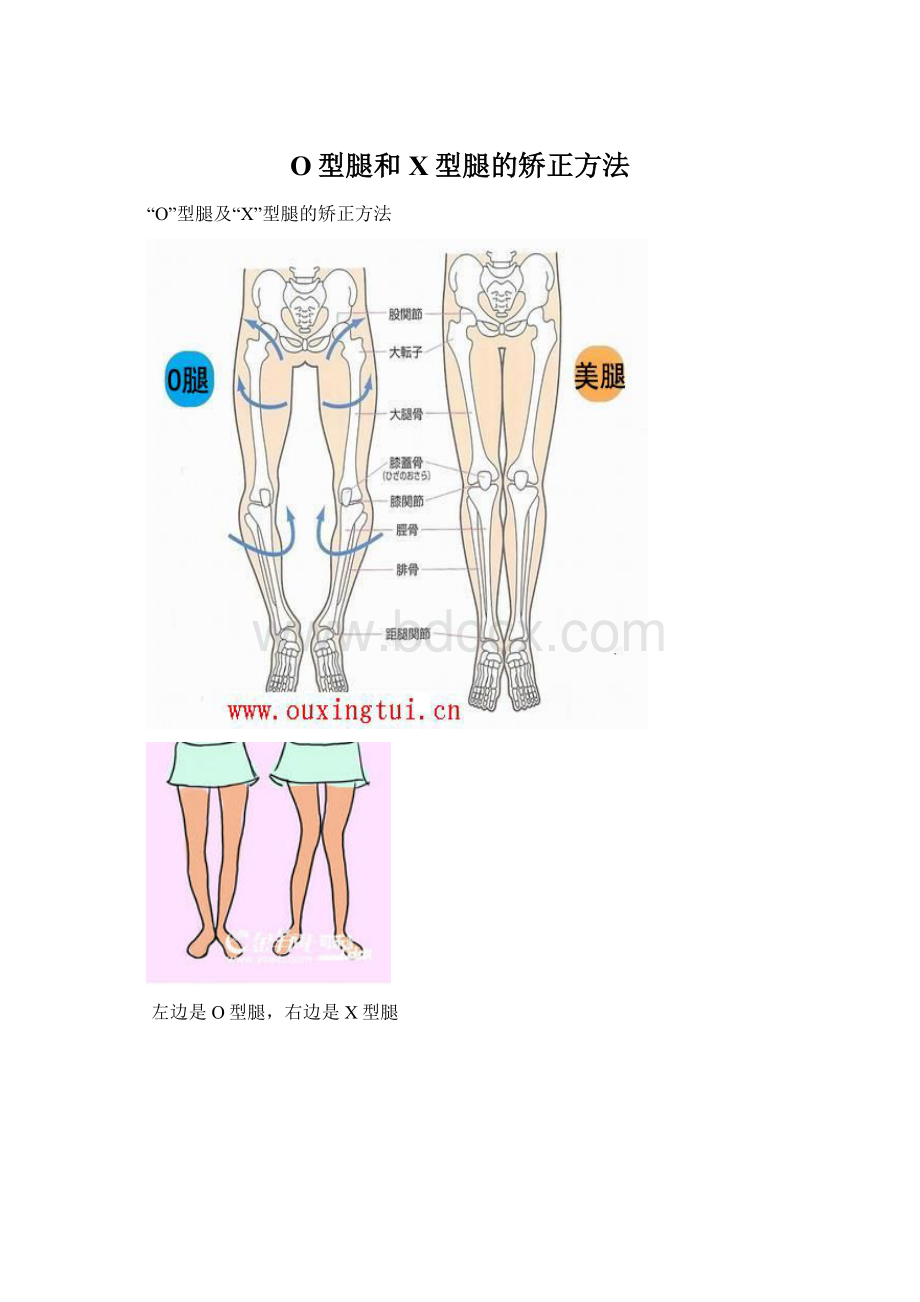 O型腿和X型腿的矫正方法Word下载.docx_第1页