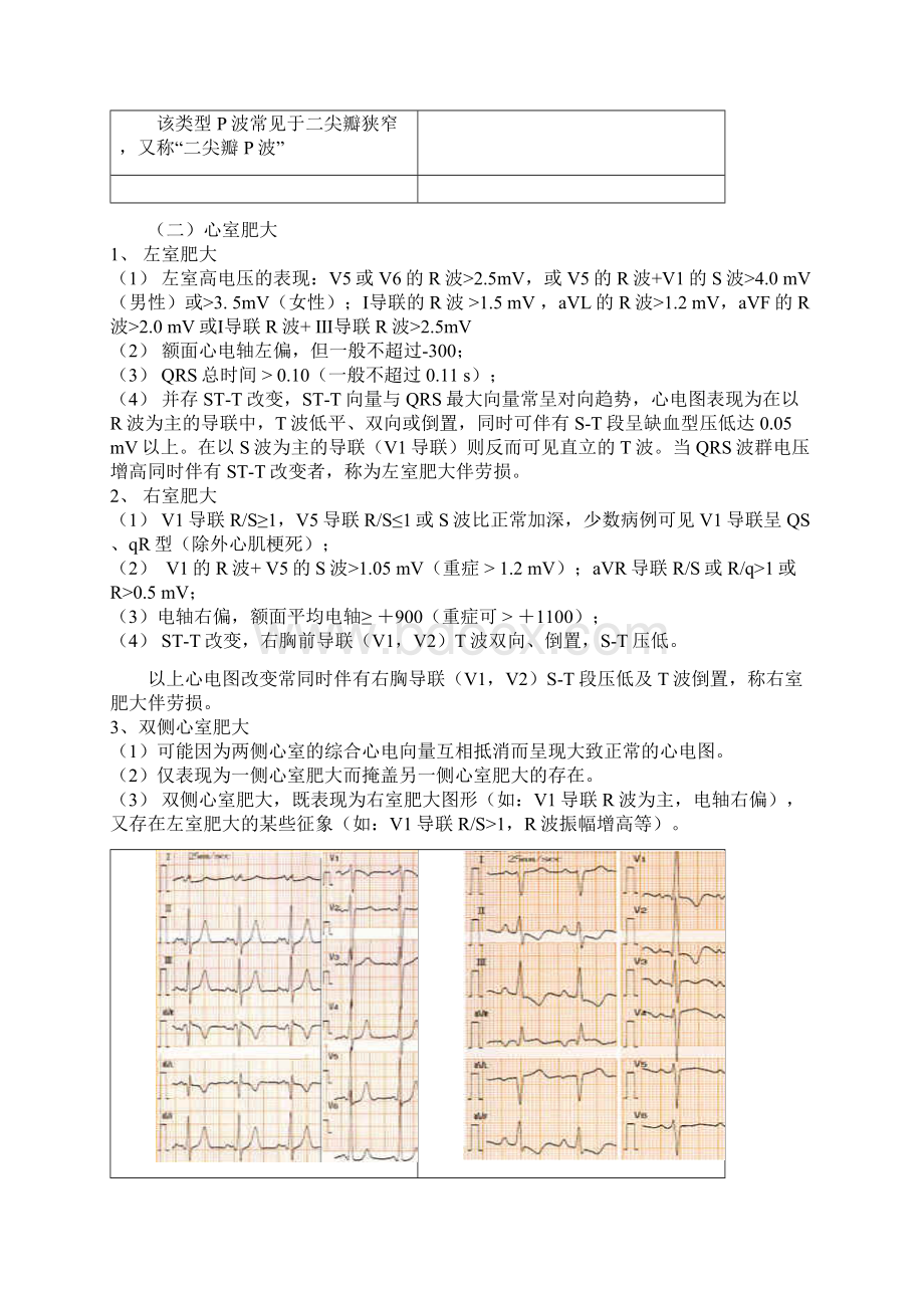 心电图基础知识.docx_第3页