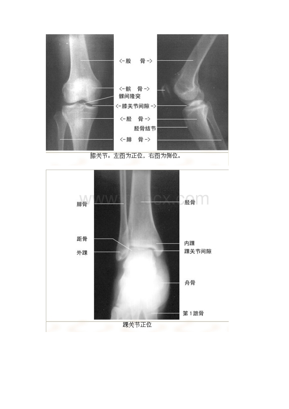 X线片文档格式.docx_第3页