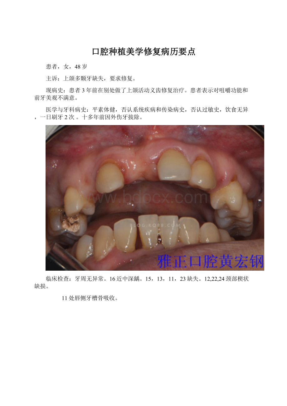 口腔种植美学修复病历要点.docx_第1页