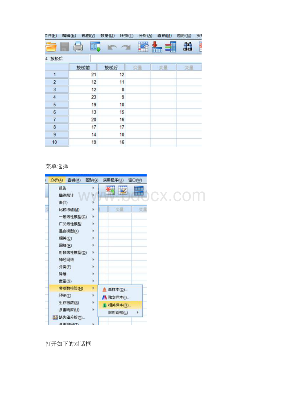 两配对样本的非参数检验Word下载.docx_第2页