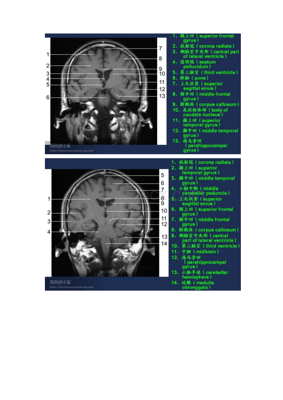 MR图谱.docx_第2页