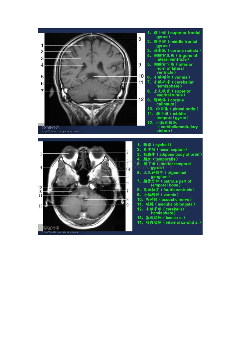 MR图谱.docx_第3页