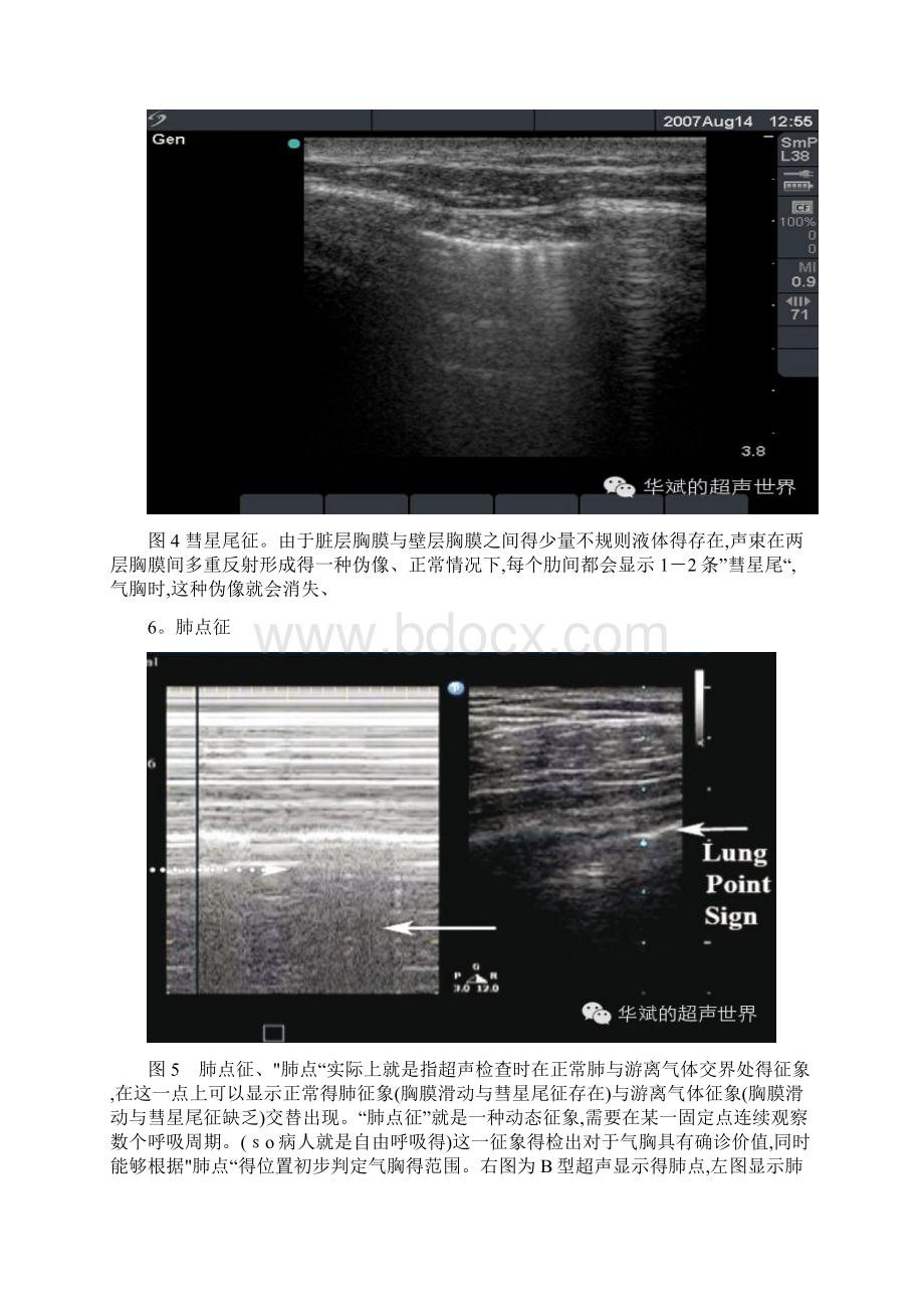 肺部超声一些常见形象征象的解释.docx_第3页