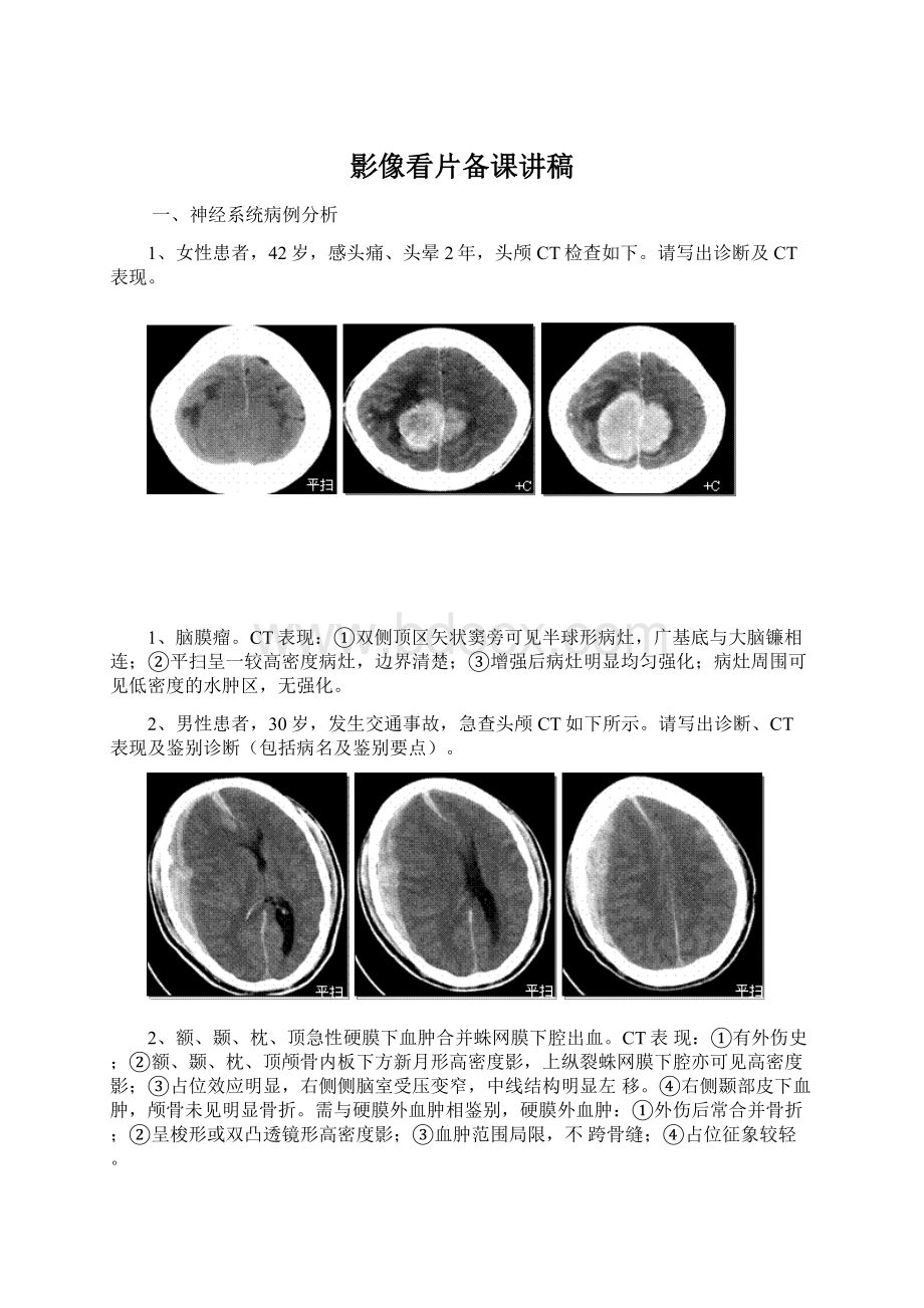 影像看片备课讲稿Word文件下载.docx_第1页