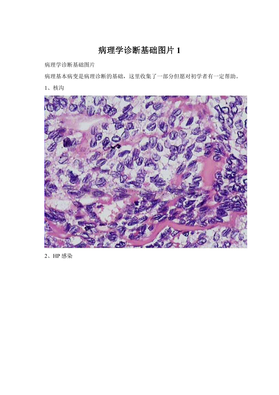 病理学诊断基础图片 1.docx_第1页