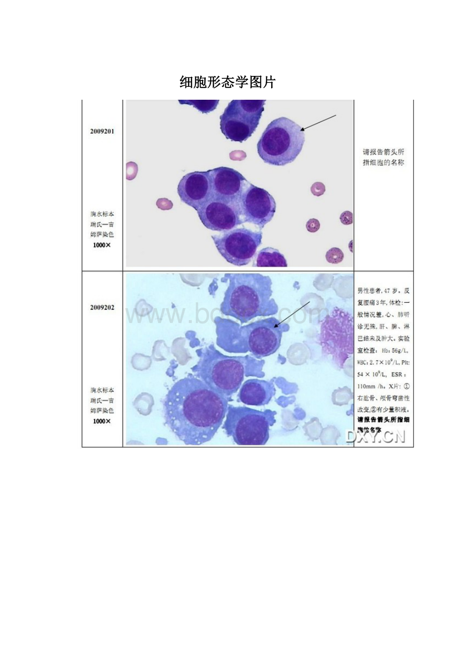 细胞形态学图片.docx_第1页