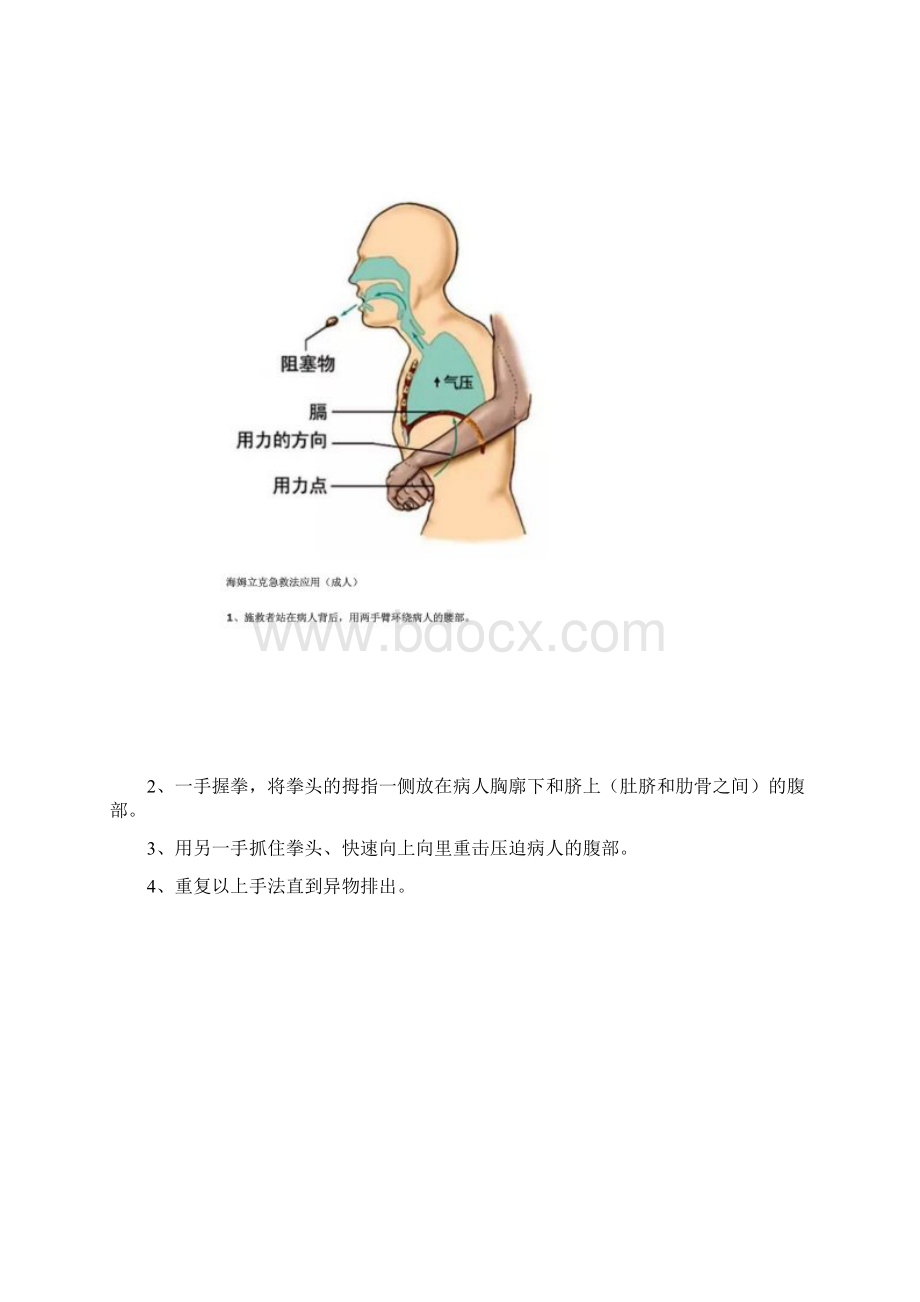 食物呛咳的方法海姆立克急救法.docx_第3页