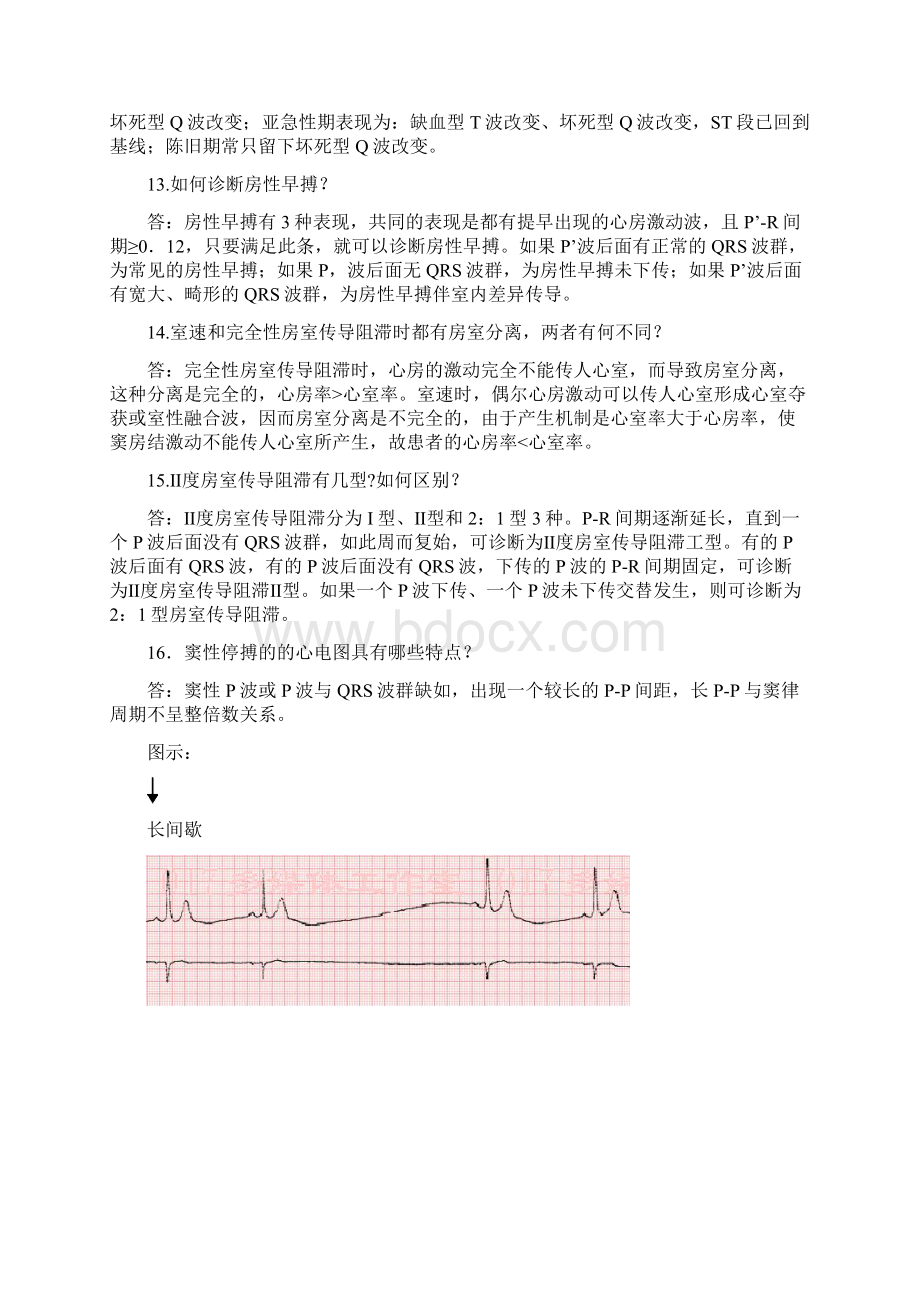 心电图问答题 文档.docx_第3页