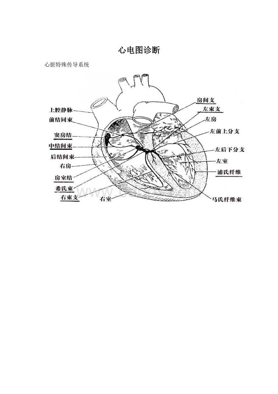 心电图诊断Word文件下载.docx